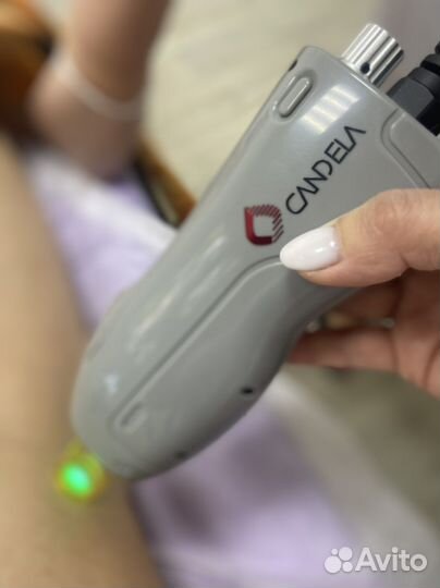 Обучение работе на александритовом лазере