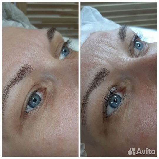 Ламинирование ресниц