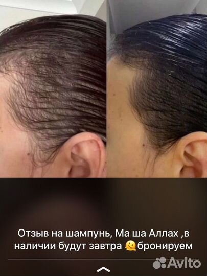 Лечебный шампунь