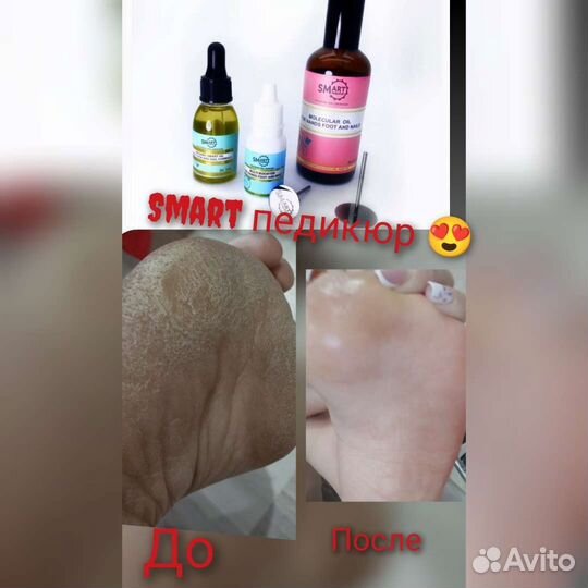 Педикюр, SMART педикюр, мужской,к пожилым выезд