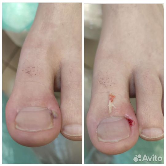 Сложный педикюр с проблемными ногами