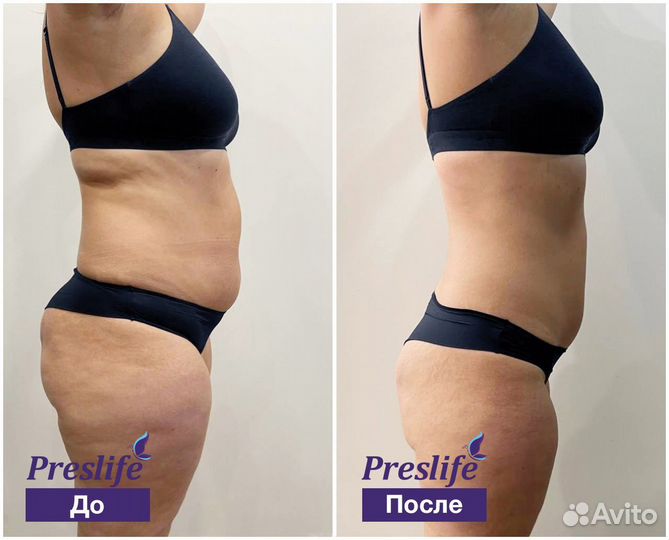 Коррекция фигуры и омоложение 7в1