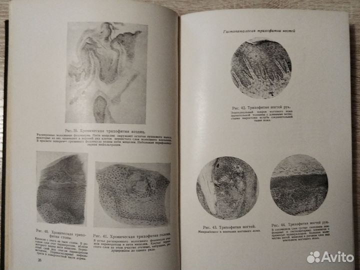 Атлас грибковых заболеваний кожи Ариевич 1951