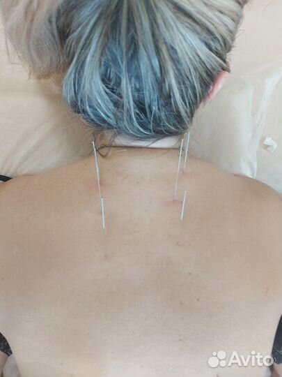 Массаж массажист акупунктура