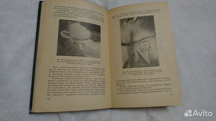 Судебная медицина учебник, лекции/Дынкина, Пауков