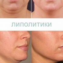 Уберу второй подбородок врач -косметолог, Красногорск
