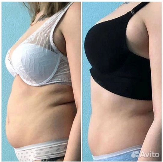 Похудение 15 процедур