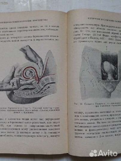 Акушерско-гинекологическая пропедевтика 1929г