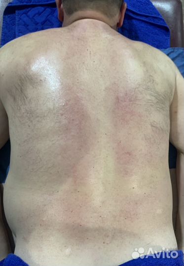 Массаж и реабилитация