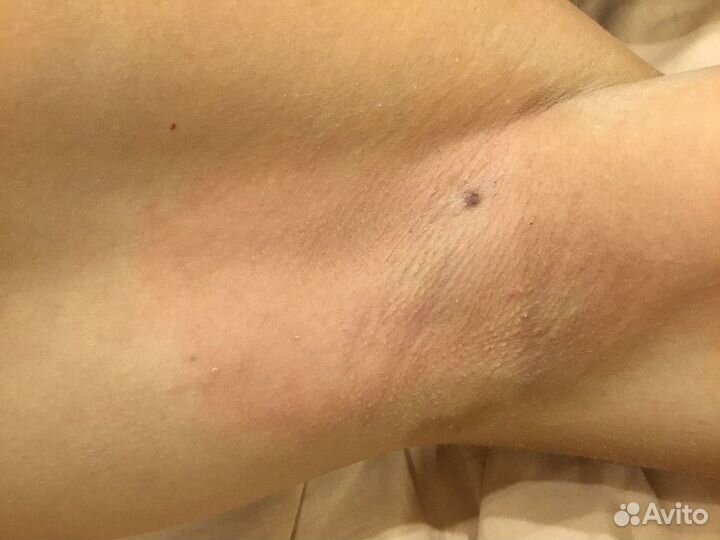 Шугаринг Лётчики Гагаринский