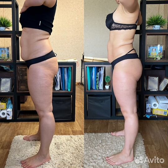 Массаж лица и тела