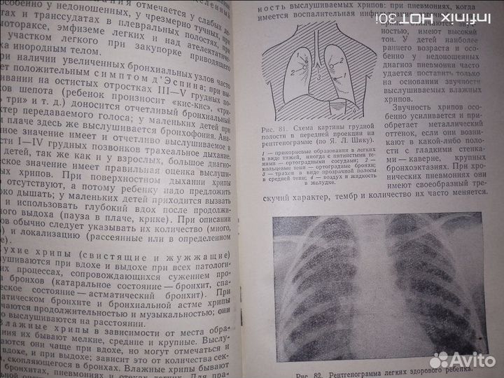 Пропедевтика детских болезней