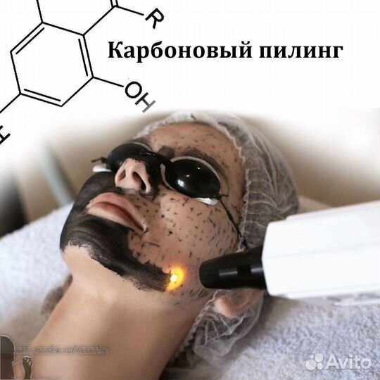 Лазер.удаление тату,карбоновый пилинг,кератин