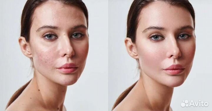 Плагины retouch4me для Photoshop