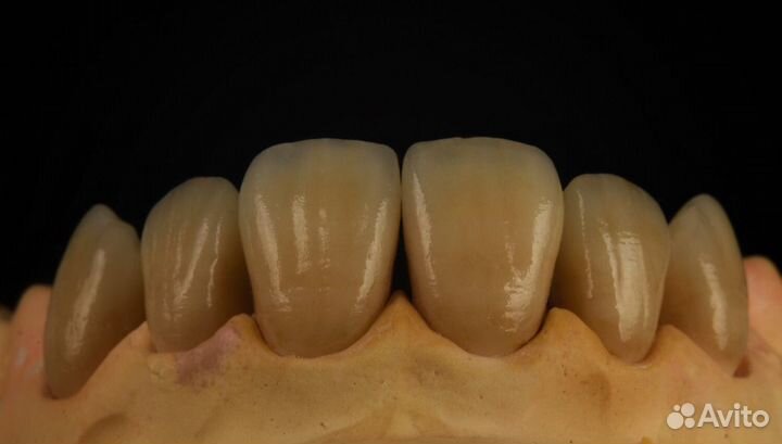 Зуботехнические услуги