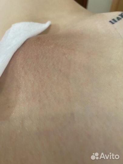 Восковая депиляция, шугаринг