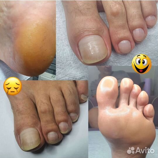 Услуги подолога, мастера педикюра и маникюра