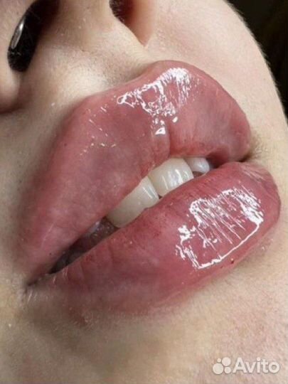 Увеличение губ скулы углы Джоли фулфейс