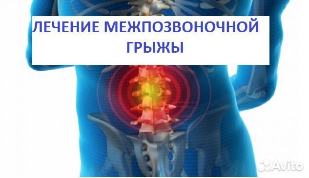 Лечение грыжи