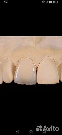 Зубной техник-керамист