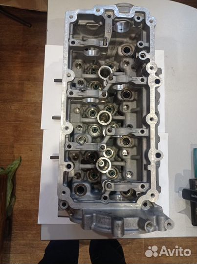 Гбц левая casa