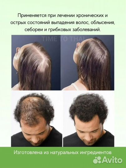 Сыворотка против выпадения волос