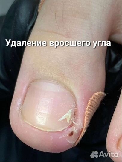 Педикюр с выездом на дом