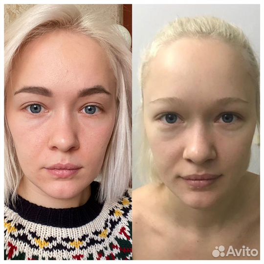 Шугаринг массаж