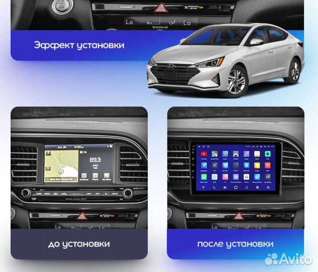 Магнитола Hyundai Elantra 6 AD (2018-2021) Teyes