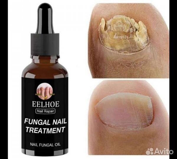 Ногтевое противогрибковое средство