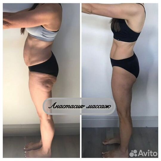 Антицеллюлитный массаж