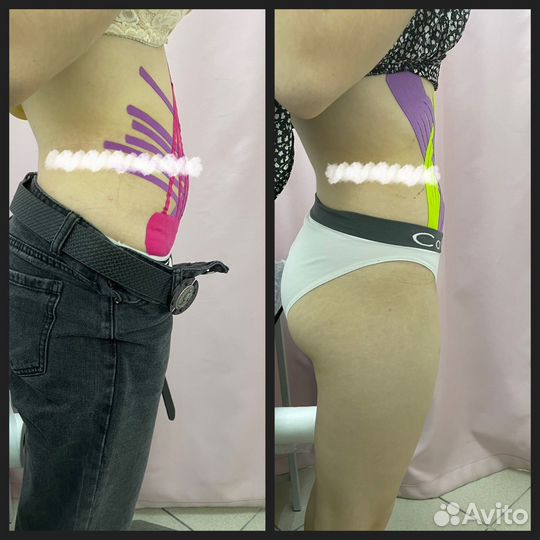 Тейпирование тела и лица