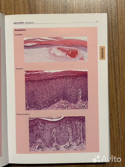 Атлас дерматопатологии Бург Кемпф Куцнер