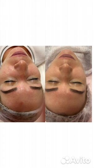 Услуги Косметолога