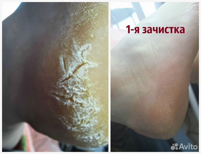 Услуги подолога