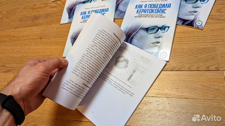 Как я победила кератоконус