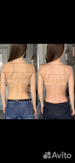 Оздоровительный массаж Балтрайон