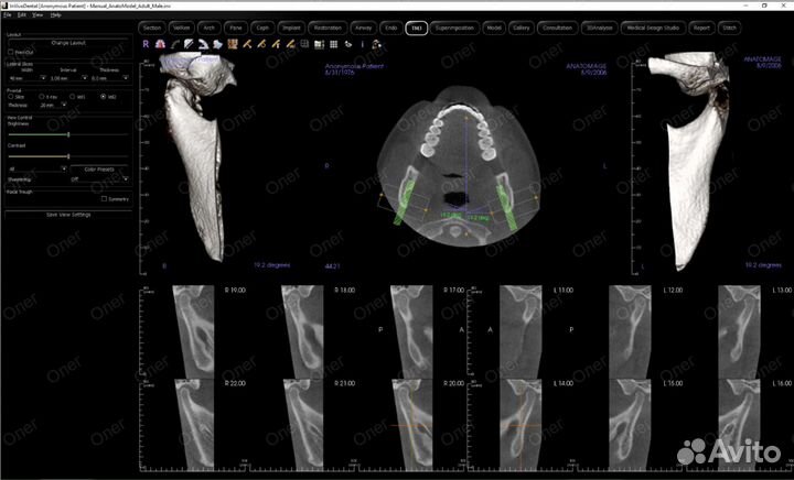Invivo 7.1.3 2024 года