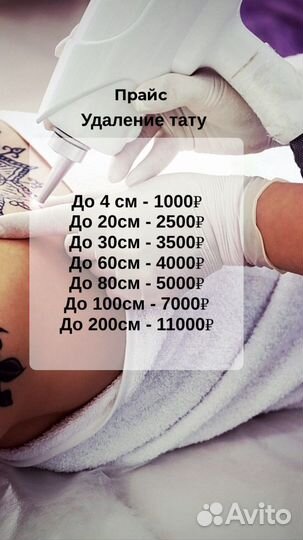 Удаление тату