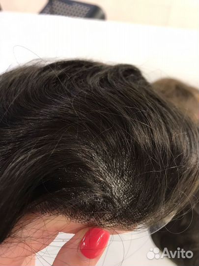 Система замещения волос