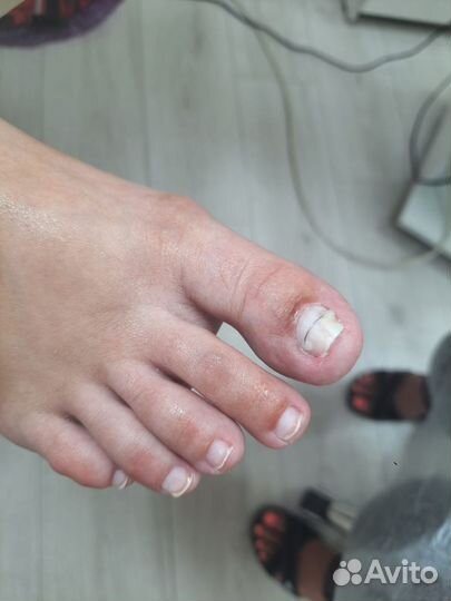 Курсы по подологии для начинающих