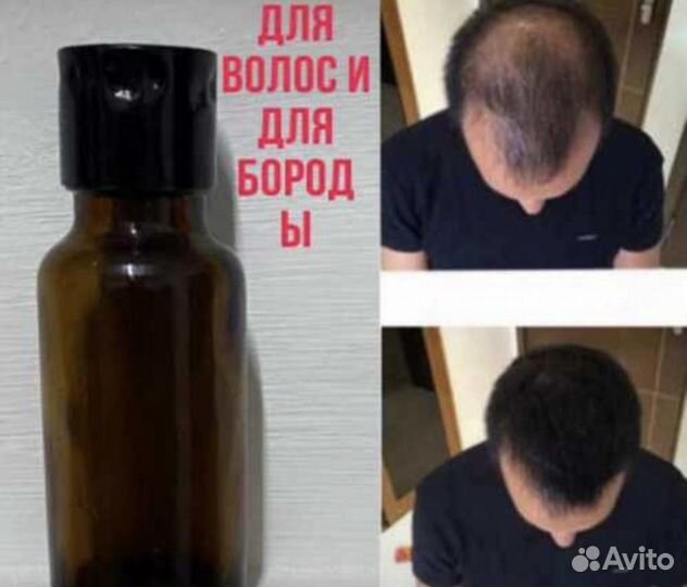 Масла для роста волос и бороды