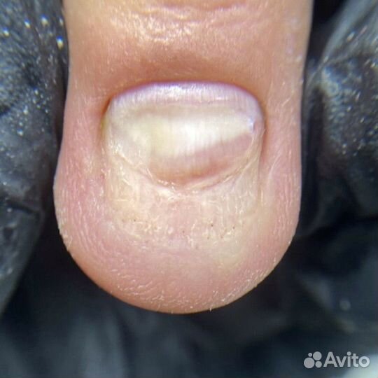 Медецинский педикюр.подолог.для мужчин И женщин