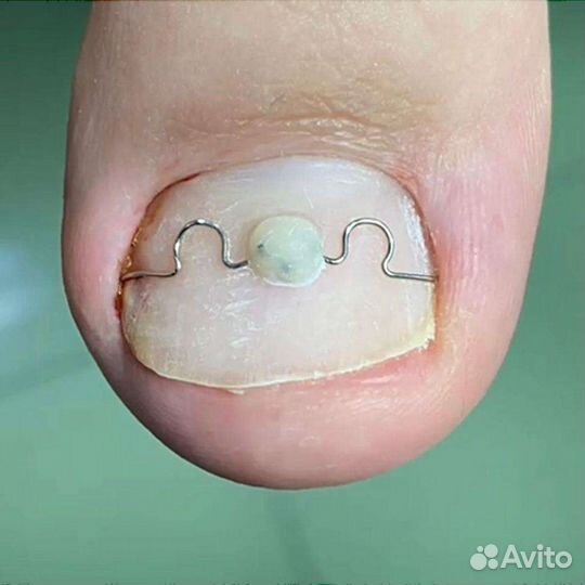 Подолог. Медицинский педикюр