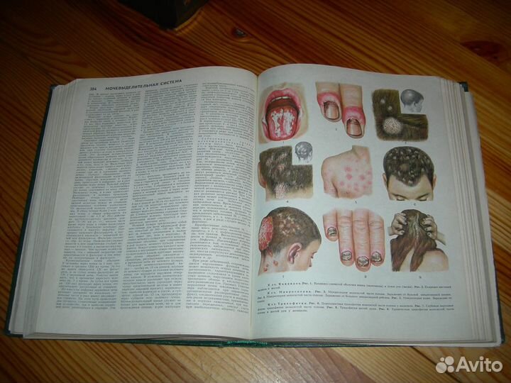 Книга Популярная медицинская энциклопедия 1980 год