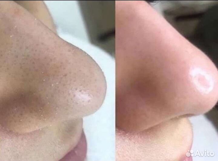 Косметолог эстетист