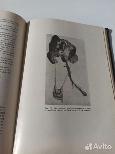 Книга периода СССР, болезнь почек 1969 г