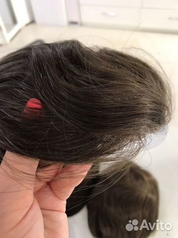 Система замещения волос