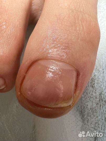 Подолог / маникюр / педикюр