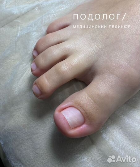 Подолог / медицинский педикюр